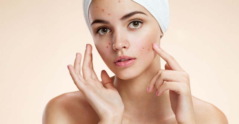 acne pustule treatment